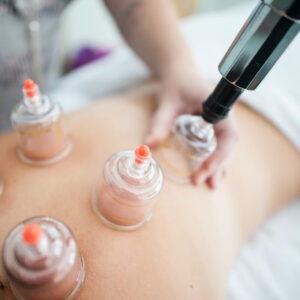 vacumn cupping therapy wicklow